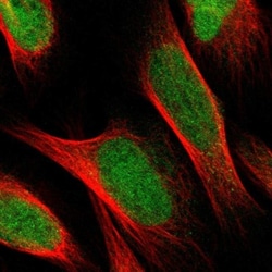 Ellis van Creveld syndrome Antibody, Novus Biologicals 25 &mu;L; Unlabeled:Antibodies,